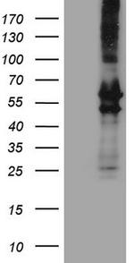 PRPH Antibody in Western Blot (WB)