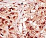 PRPK Antibody in Immunohistochemistry (IHC)
