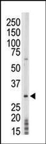 PRPK Antibody in Western Blot (WB)