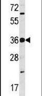 PRPK Antibody in Western Blot (WB)