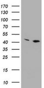 PRR11 Antibody in Western Blot (WB)
