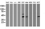 PRR11 Antibody in Western Blot (WB)