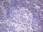 PRRX1 Antibody in Immunohistochemistry (Paraffin) (IHC (P))