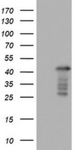 PRRX1 Antibody in Western Blot (WB)