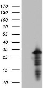 PRRX1 Antibody in Western Blot (WB)