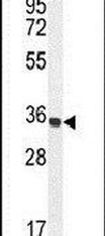 Trypsin Antibody in Western Blot (WB)