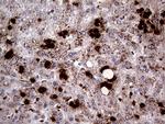 PRTN3 Antibody in Immunohistochemistry (Paraffin) (IHC (P))