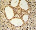 PRUNE Antibody in Immunohistochemistry (IHC)
