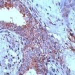 PSCA Antibody in Immunohistochemistry (IHC)