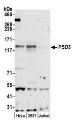 PSD3 Polyclonal Antibody