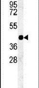 PSG9 Antibody in Western Blot (WB)