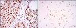 PSIP1 Antibody in Immunohistochemistry (Paraffin) (IHC (P))