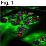 ITIH2 Antibody in Immunohistochemistry (Paraffin) (IHC (P))