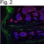 ITIH2 Antibody in Immunohistochemistry (Paraffin) (IHC (P))