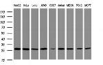 PSMA2 Antibody in Western Blot (WB)
