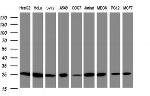 PSMA2 Antibody in Western Blot (WB)