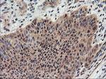 PSMA4 Antibody in Immunohistochemistry (Paraffin) (IHC (P))