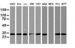 PSMA4 Antibody in Western Blot (WB)