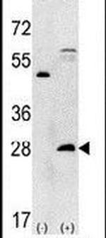PSMA5 Antibody in Western Blot (WB)