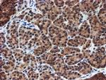 PSMA6 Antibody in Immunohistochemistry (Paraffin) (IHC (P))