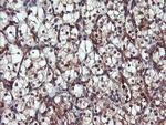 PSMA6 Antibody in Immunohistochemistry (Paraffin) (IHC (P))