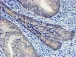 PSMA6 Antibody in Immunohistochemistry (Paraffin) (IHC (P))
