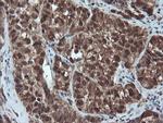 PSMA6 Antibody in Immunohistochemistry (Paraffin) (IHC (P))