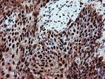 PSMA6 Antibody in Immunohistochemistry (Paraffin) (IHC (P))