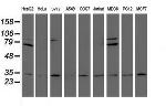 PSMA6 Antibody in Western Blot (WB)