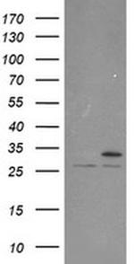PSMA6 Antibody in Western Blot (WB)