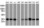 PSMA6 Antibody in Western Blot (WB)
