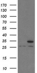 PSMA6 Antibody in Western Blot (WB)