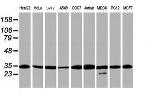PSMA6 Antibody in Western Blot (WB)