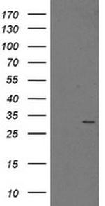 PSMA6 Antibody in Western Blot (WB)