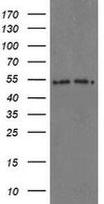 PSMA6 Antibody in Western Blot (WB)