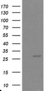 PSMA6 Antibody in Western Blot (WB)