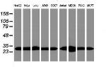 PSMA6 Antibody in Western Blot (WB)