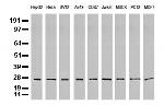 PSMA6 Antibody in Western Blot (WB)
