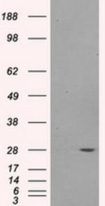 PSMA7 Antibody in Western Blot (WB)