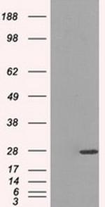 PSMA7 Antibody in Western Blot (WB)