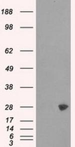 PSMA7 Antibody in Western Blot (WB)