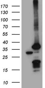 PSMA7 Antibody in Western Blot (WB)