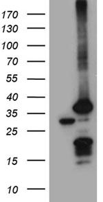 PSMA7 Antibody in Western Blot (WB)
