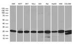 PSMA7 Antibody in Western Blot (WB)
