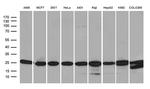 PSMA7 Antibody in Western Blot (WB)