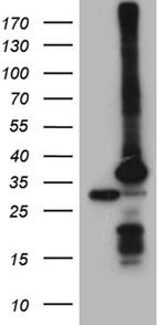 PSMA7 Antibody in Western Blot (WB)