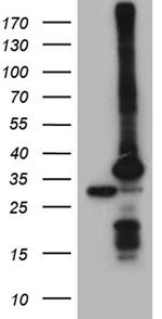 PSMA7 Antibody in Western Blot (WB)