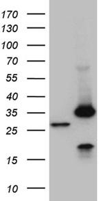 PSMA7 Antibody in Western Blot (WB)