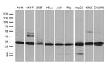 PSMA7 Antibody in Western Blot (WB)