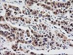 PSMB4 Antibody in Immunohistochemistry (Paraffin) (IHC (P))